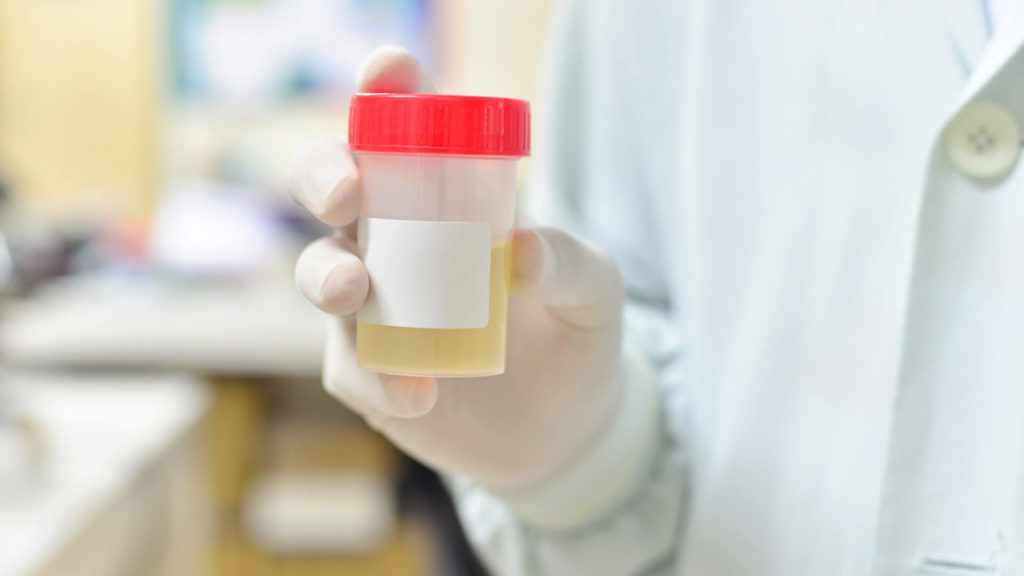 Gonoré symptomer - 4 - Blodsjekk