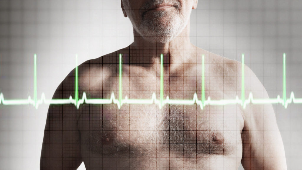 Kolesterol - 3 - Blodsjekk