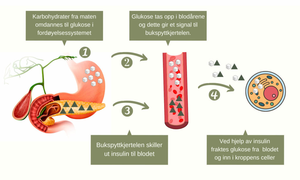 Insulinresistens - Glukose - Blodsjekk
