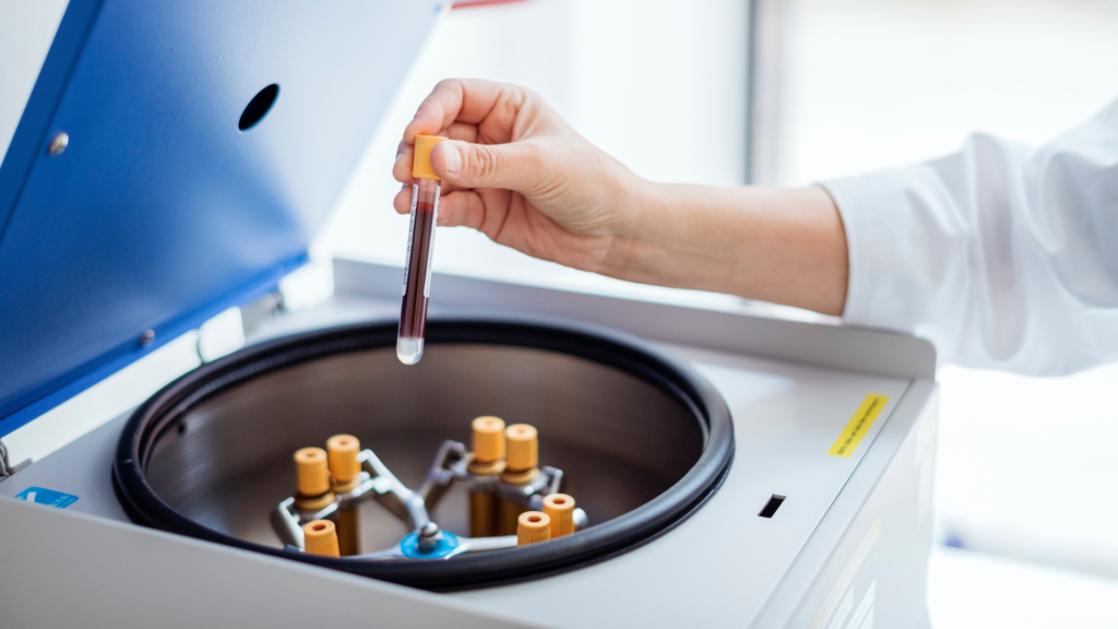 Det er viktig at helsepersonell som utfører prøvetakingen og laboratoriet som analyserer prøven følger standariserte retningslinjer for å unngå feil prøvesvar. 