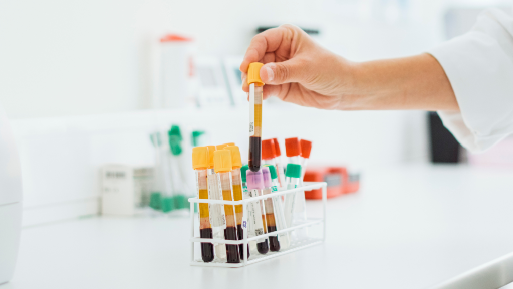 Lege holder rør. med blodprøver som symboliserer viktigheten av blodprøver for å utrede bakenforliggende årsaker til tretthet.