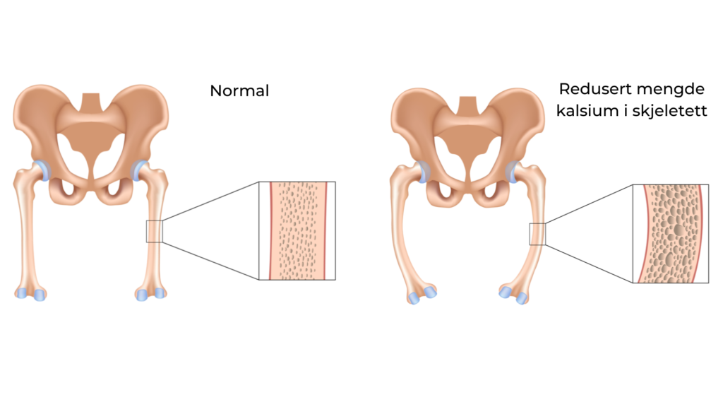 Vitamin D er viktig for oppbygging av et sterkt skjelett
