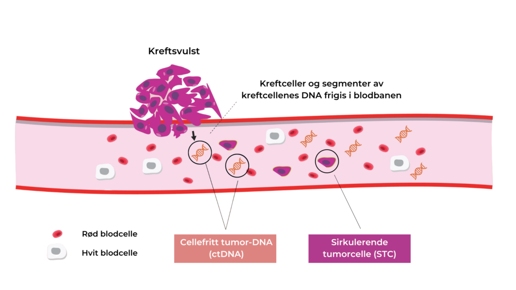 Påvisning av kreftceller som sirkulerer i blodet og fragmenter av deres DNA  vil kunne bli et viktig verktøy i behandling og diagnostisering av kreft.