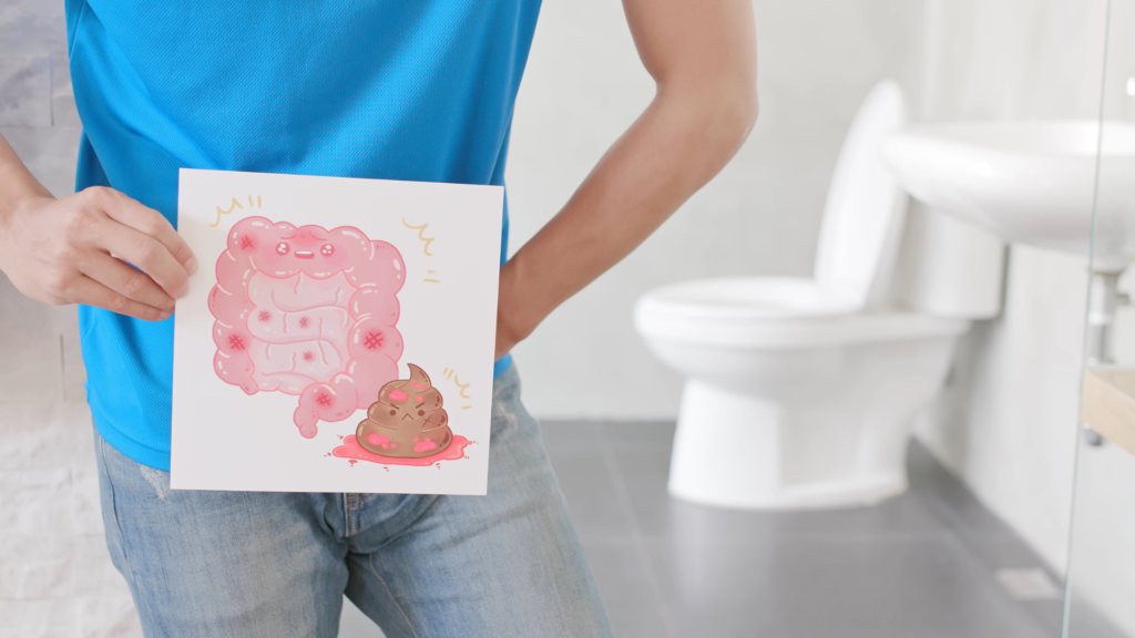 Over halvparten av pasienter med tarmkreft har observert blod i avføringen.