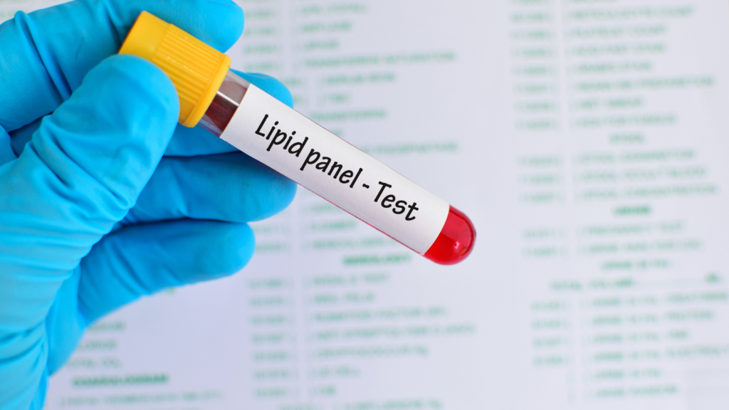 Høye nivåer av fettstoffer gir vanligvis ingen symptomer og kan bare diagnostiseres ved hjelp av blodprøver