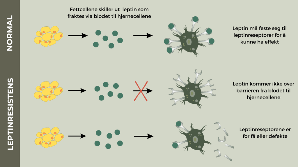 Hvis hjernen mangler leptin, eller leptinreseptorene er få eller defekte, får ikke leptin gitt beskjed til hjernens metthetssenteret om å dempe appetitten.