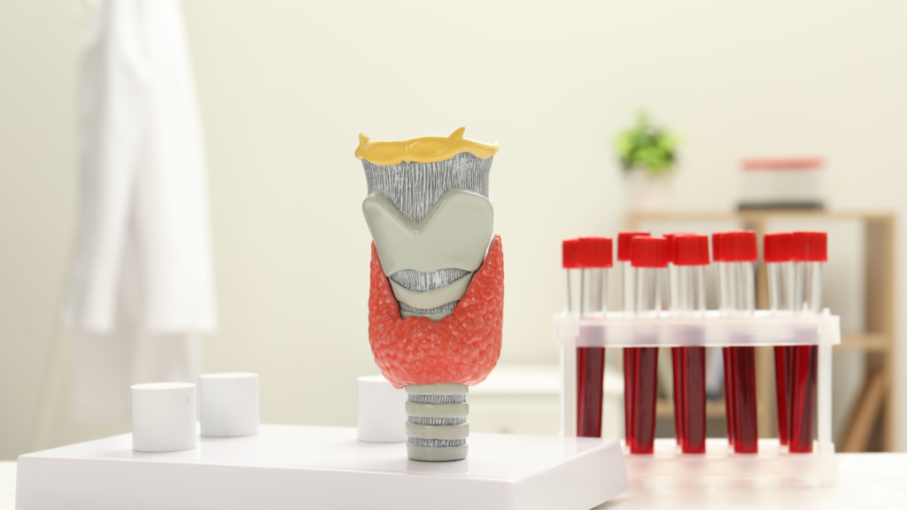 Diagnosen høyt stoffskifte bekreftes ved hjelp av en blodprøve.